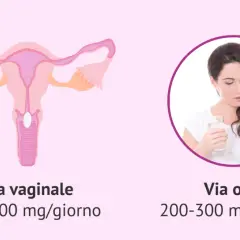 Illustrazione anatomica dell'utero con un ovulo inserito, e una donna che prende una pillola per via orale. Indicazioni su come inserire ovuli e dosaggi.
