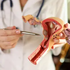 Modello anatomico dell'utero e delle ovaie, con evidenziate le perdite ad albume d'uovo.
