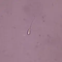 Un singolo spermatozoo al microscopio. La quantità di liquido seminale necessaria per rimanere incinta varia, ma la presenza di spermatozoi vitali è fondamentale.