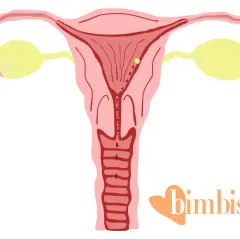 Illustrazione anatomica dell'utero con dettagli che suggeriscono immagini falso ciclo.