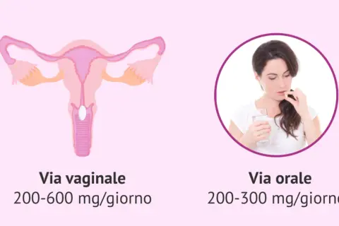 Illustrazione anatomica dell'utero con un ovulo inserito, e una donna che prende una pillola per via orale. Indicazioni su come inserire ovuli e dosaggi.