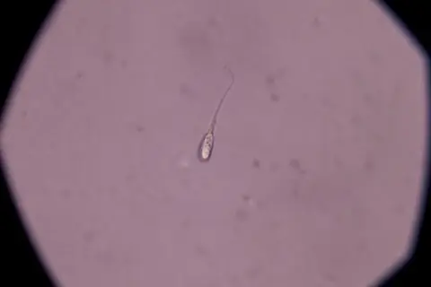 Un singolo spermatozoo al microscopio. La quantità di liquido seminale necessaria per rimanere incinta varia, ma la presenza di spermatozoi vitali è fondamentale.