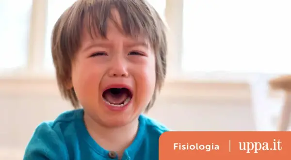 Un neonato di 6 mesi urla acutamente, con gli occhi chiusi e la bocca spalancata.