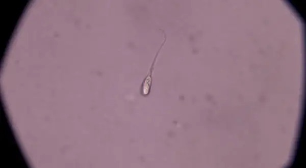 Un singolo spermatozoo al microscopio. La quantità di liquido seminale necessaria per rimanere incinta varia, ma la presenza di spermatozoi vitali è fondamentale.