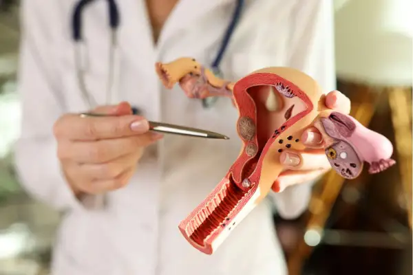 Modello anatomico dell'utero e delle ovaie, con evidenziate le perdite ad albume d'uovo.