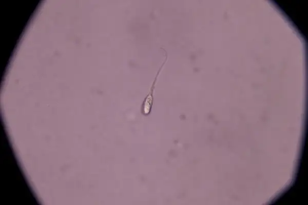 Un singolo spermatozoo al microscopio. La quantità di liquido seminale necessaria per rimanere incinta varia, ma la presenza di spermatozoi vitali è fondamentale.